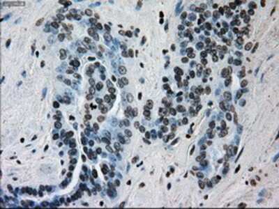 Immunohistochemistry-Paraffin: ERCC1 Antibody (OTI1A3) [NBP1-47733]