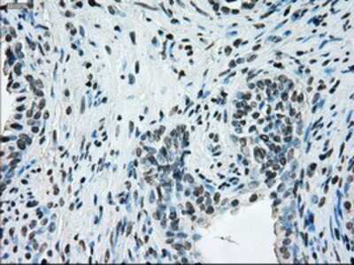 Immunohistochemistry-Paraffin: ERCC1 Antibody (OTI1A3) [NBP1-47733]
