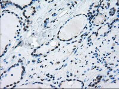 Immunohistochemistry-Paraffin: ERCC1 Antibody (OTI1A3) [NBP1-47733]