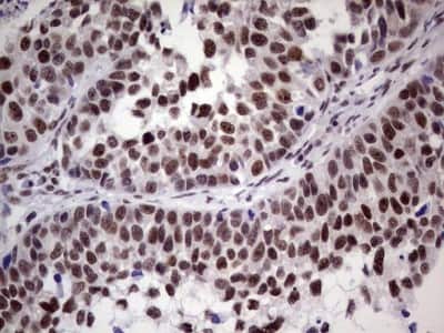 Immunohistochemistry: ERCC1 Antibody (OTI2H1) [NBP2-45501]