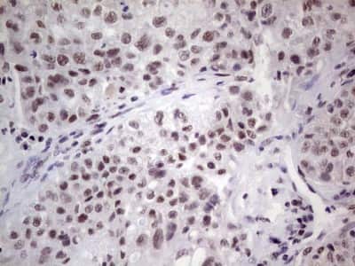 Immunohistochemistry: ERCC1 Antibody (OTI2H1) [NBP2-45501]