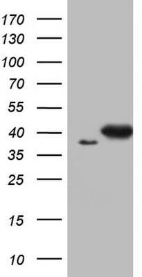 Western Blot: ERCC1 Antibody (OTI2H1) [NBP2-45501]