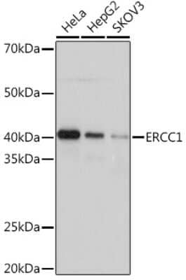 Western Blot: ERCC1 Antibody (5F9U0) [NBP3-16521]