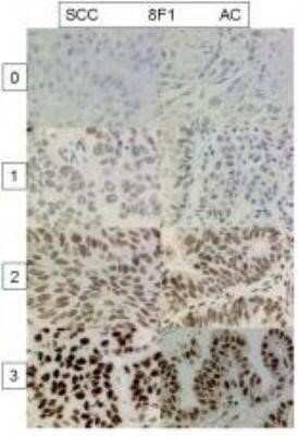 Immunohistochemistry: ERCC1 Antibody (8F1) - Azide and BSA Free [NBP2-80725]