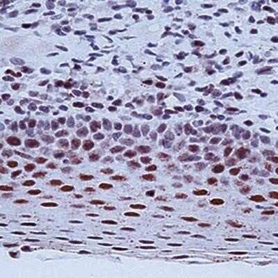 Immunohistochemistry-Paraffin: ERCC1 Antibody (8F1) - Azide and BSA Free [NBP2-80725]
