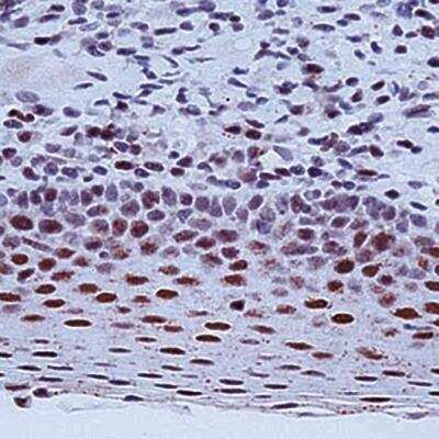Immunohistochemistry-Paraffin: ERCC1 Antibody (8F1) - BSA Free [NB500-704]