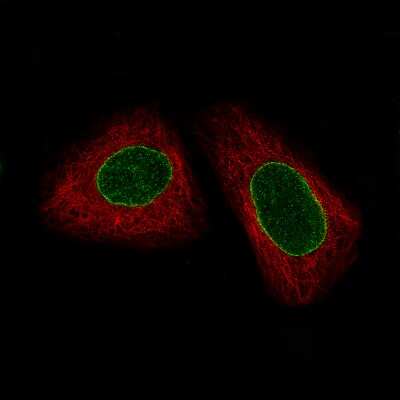 Immunocytochemistry/ Immunofluorescence: ERCC1 Antibody (CL1249) [NBP2-34479]