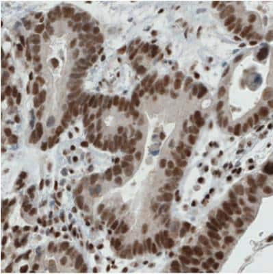 Immunohistochemistry: ERCC1 Antibody (CL1249) [NBP2-34479]