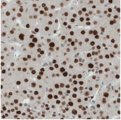 Immunohistochemistry: ERCC1 Antibody (CL1249) [NBP2-34479]