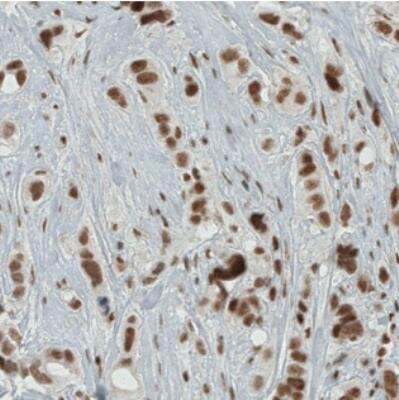 Immunohistochemistry: ERCC1 Antibody (CL1249) [NBP2-34479]