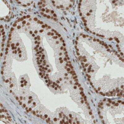 Immunohistochemistry: ERCC1 Antibody (CL1249) [NBP2-34479]