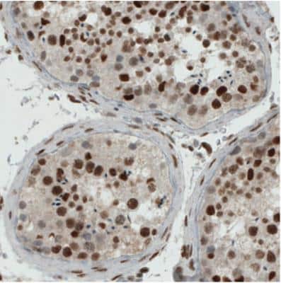 Immunohistochemistry: ERCC1 Antibody (CL1249) [NBP2-34479]
