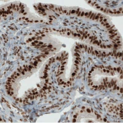 Immunohistochemistry: ERCC1 Antibody (CL1249) [NBP2-34479]