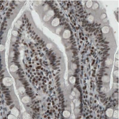 Immunohistochemistry: ERCC1 Antibody (CL1249) [NBP2-34479]