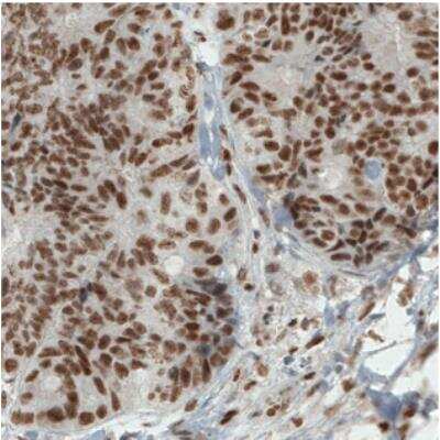 Immunohistochemistry-Paraffin: ERCC1 Antibody (CL1284) [NBP2-34480]