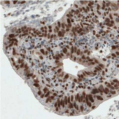 Immunohistochemistry-Paraffin: ERCC1 Antibody (CL1284) [NBP2-34480]
