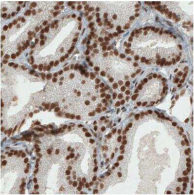 Immunohistochemistry-Paraffin: ERCC1 Antibody (CL1284) [NBP2-34480]