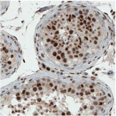 Immunohistochemistry-Paraffin: ERCC1 Antibody (CL1284) [NBP2-34480]