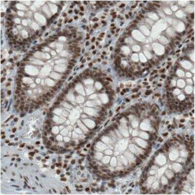 Immunohistochemistry-Paraffin: ERCC1 Antibody (CL1284) [NBP2-34480]
