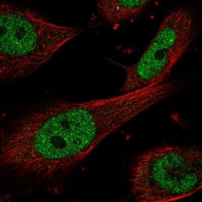 Immunocytochemistry/ Immunofluorescence: ERCC1 Antibody [NBP2-55616]