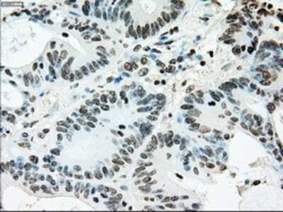 Immunohistochemistry: ERCC1 Antibody (OTI1A3) - Azide and BSA Free [NBP2-70662]