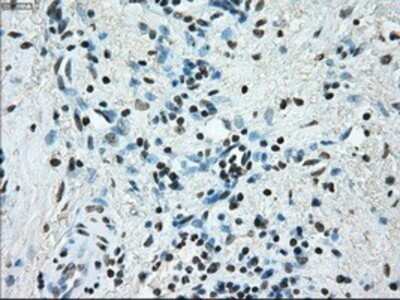 Immunohistochemistry: ERCC1 Antibody (OTI1A3) - Azide and BSA Free [NBP2-70662]