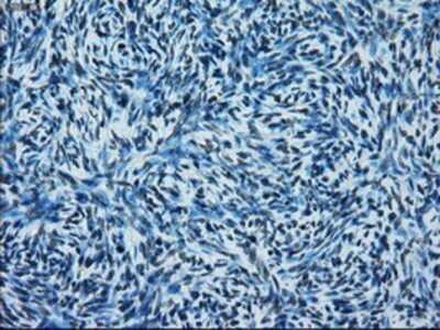 Immunohistochemistry: ERCC1 Antibody (OTI1A3) - Azide and BSA Free [NBP2-70662]