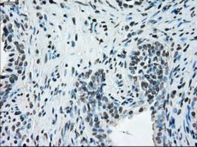 Immunohistochemistry: ERCC1 Antibody (OTI1A3) - Azide and BSA Free [NBP2-70662]