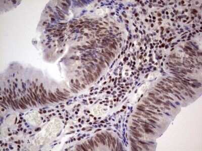 Immunohistochemistry: ERCC1 Antibody (OTI2H1) - Azide and BSA Free [NBP2-70685]