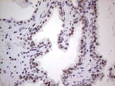 Immunohistochemistry: ERCC1 Antibody (OTI2H1) - Azide and BSA Free [NBP2-70685]
