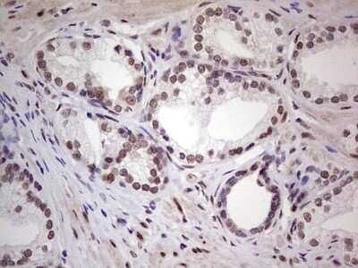 Immunohistochemistry: ERCC1 Antibody (OTI2H1) - Azide and BSA Free [NBP2-70685]