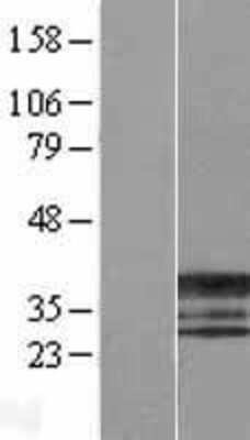 Western Blot: ERCC1 Overexpression Lysate [NBL1-10318]