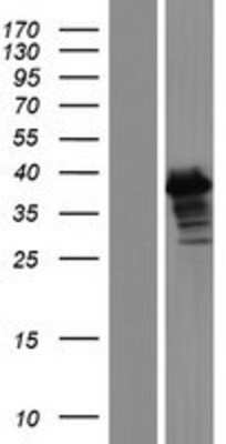 Western Blot: ERCC1 Overexpression Lysate [NBL1-10319]