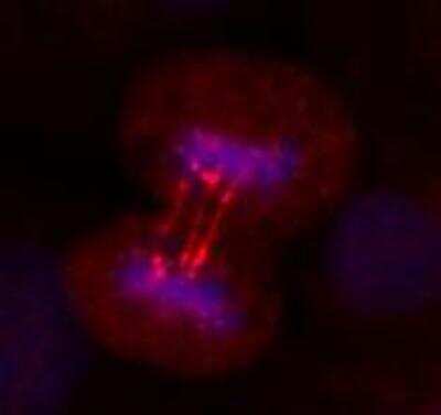 Immunocytochemistry/ Immunofluorescence: ERCC6L Antibody [H00054821-D01P]