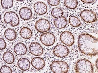 Immunohistochemistry-Paraffin: ERCC6L Antibody [NBP2-97609]