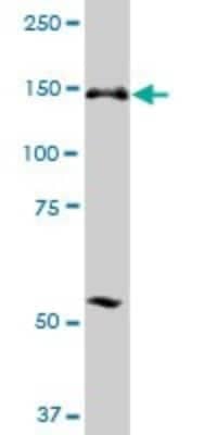 Western Blot: ERCC6L Antibody [H00054821-B01P]