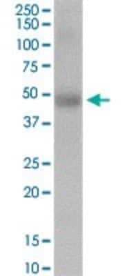 Western Blot: ERCC6L Antibody [H00054821-D01P]