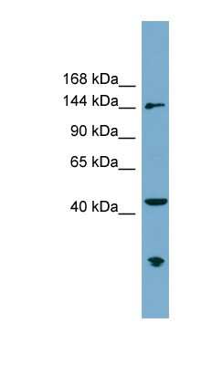 Western Blot: ERCC6L Antibody [NBP1-56332]