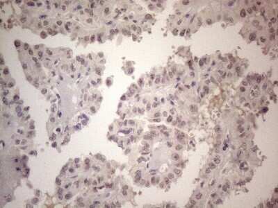 Immunohistochemistry: ERCC8 Antibody (OTI2G1) [NBP2-45519]