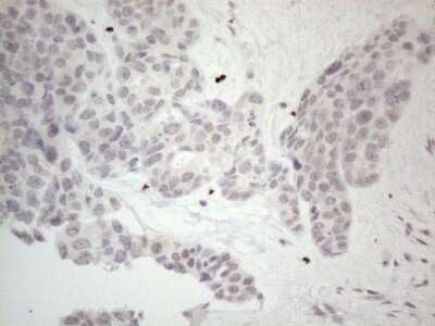 Immunohistochemistry: ERCC8 Antibody (OTI2G1) [NBP2-45519]