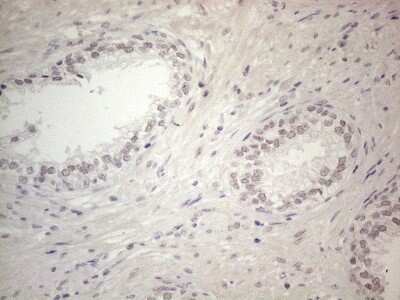 Immunohistochemistry: ERCC8 Antibody (OTI2G1) [NBP2-45519]
