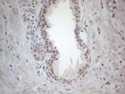 Immunohistochemistry: ERCC8 Antibody (OTI2G1) [NBP2-45519]