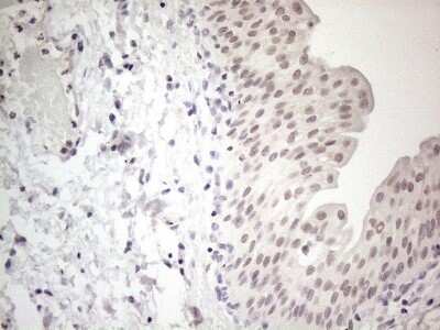 Immunohistochemistry: ERCC8 Antibody (OTI2G1) [NBP2-45519]