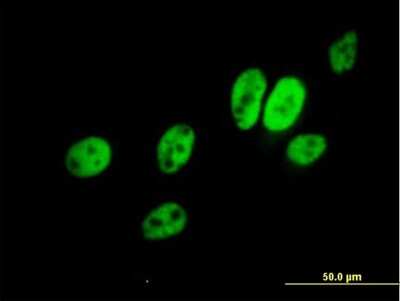 Immunocytochemistry/ Immunofluorescence: ERCC8 Antibody [H00001161-B01P]