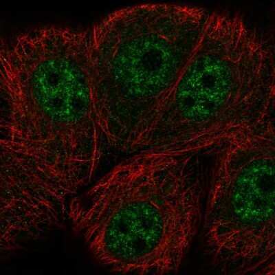 Immunocytochemistry/ Immunofluorescence: ERCC8 Antibody [NBP2-58562]