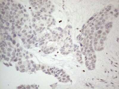 Immunohistochemistry: ERCC8 Antibody (OTI2G1) - Azide and BSA Free [NBP2-70412]