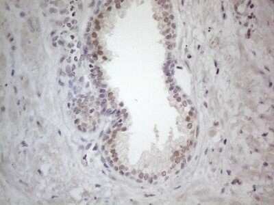 Immunohistochemistry: ERCC8 Antibody (OTI2G1) - Azide and BSA Free [NBP2-70412]