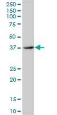 Western Blot: ERCC8 Antibody [H00001161-B01P]