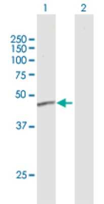 Western Blot: ERCC8 Antibody [H00001161-B01P]