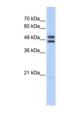 Western Blot: ERCC8 Antibody [NBP1-54898]